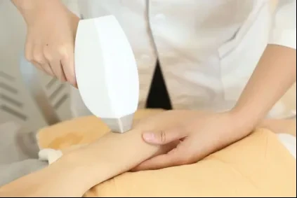 Tarif épilation permanente au laser