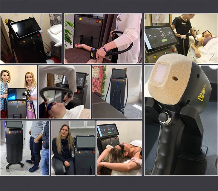 Épilation médicale au laser