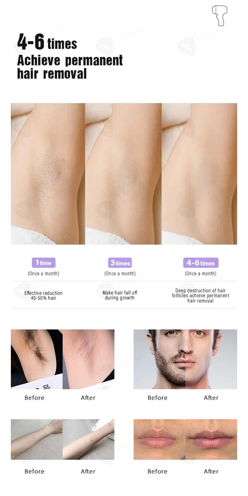 ODM/OEM Ice Titanium Laser Hair Removal Machine Factory Price