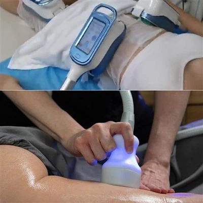 Coût de la machine Coolsculpting