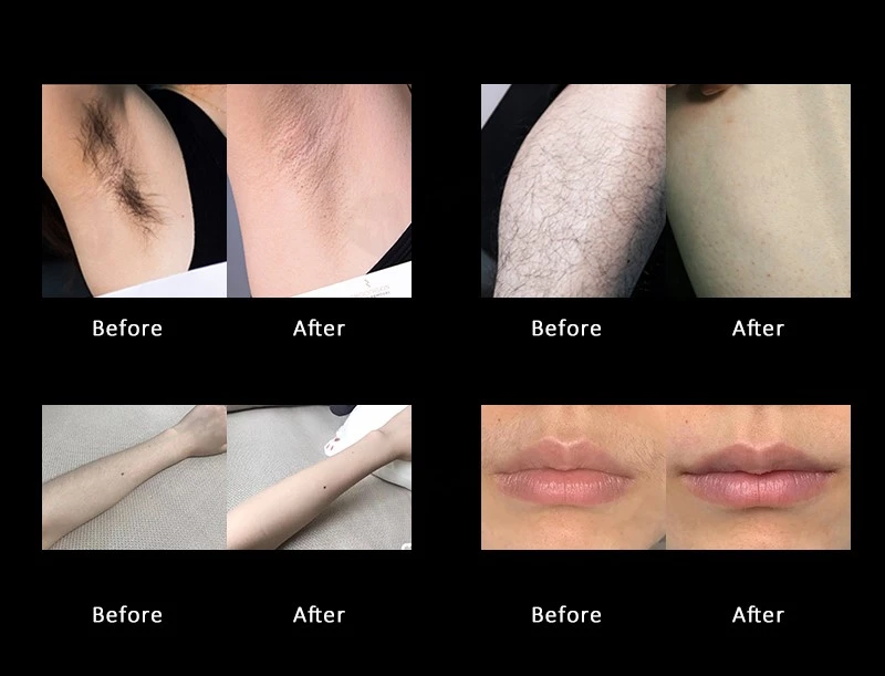 Effect comparisons Effect comparisons