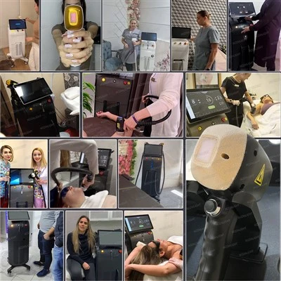 Machine d'épilation au laser hautement cotée